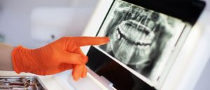 Why Test Tooth Pulp Vitality