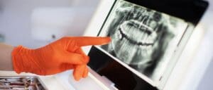 Why Test Tooth Pulp Vitality